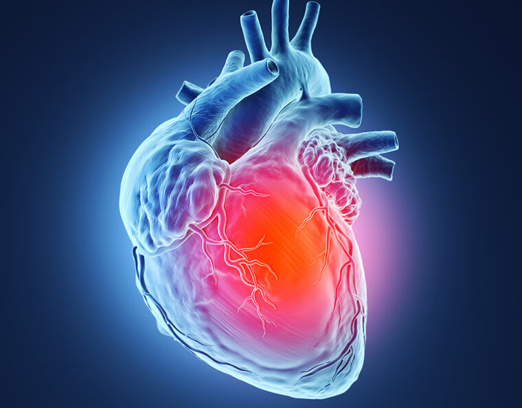 Cardiac Arrest and Heart Attack Response Volume